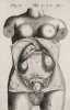 Traite des maladies des femmes grosses. Et de celles qui sont nouvellement accouchées. Nouvelle édition corrigée par l’Auteur, et augmentée de ...