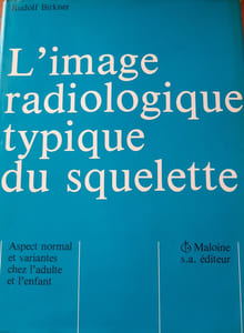 L'IMAGE RADIOLOGIQUE TYPIQUE DU SQUELETTE : aspect normal et variantes chez l'adulte et chez l'enfant.