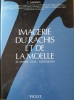 IMAGERIE DU RACHIS ET DE LA MOELLE : scanner , IRM, ultrasons. . MANELFE, CLAUDE.