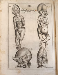 Acta medica & philosophica hafniensia. Ann. 1671 & 1672. Cum aeneis figuris.