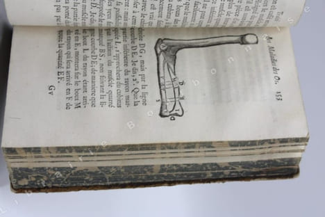 Traité des maladies des os, dans lequel on a représenté les appareils & les machines qui conviennent à leur guérison. Nouvelle édition revue & ...