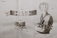 TRAITÉ DES MALADIES CHIRURGICALES ET DES OPERATIONS QUI LEUR CONVIENNENT, par le Baron Boyer, membre de la Légion d'Honneur, Professeur de chirurgie-pratique à la Faculté de Médecine de Paris, chirurgien en chef-adjoint de l'Hôpital de la Charité, Membre de plusieurs Sociétés savantes nationales et étrangères, etc.

