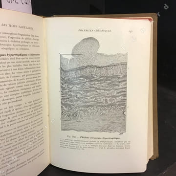 Précis d'anatomie pathologique. Tome I et II. . ROUSSY, Gustave - LEROUX, Roger - OBERLING, Charles