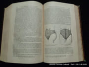 Traité pratique de l'art des accouchements par les professeurs. 2e éd. française, traduite par G.A. Aubenas. Ouvrage précédé d'une introduction par J.A. Stolz. Accompagné d'une planchesur acier et de 229 figures intercalées dans le texte. par H.F. Naegele. W.L. Grenser. - Image 6