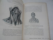 Technique du massage. par Professeur Albert Hoffa - Image 4