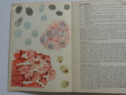 Tabulae parasitorum intestinorum. Parasites intestinaux. Biologie, diagnostic et traitement des maladies parasitaires intestinales.  par J.G. Baer, Ch. Joyeux, A. Sicé - Image 3