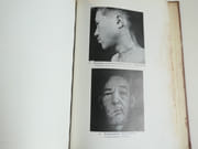Atlas of leprosy par Kensuke Mitsuda - Image 4