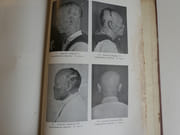 Atlas of leprosy par Kensuke Mitsuda - Image 5