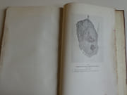 Atlas of leprosy par Kensuke Mitsuda - Image 6