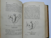 (MEDECINE) Traité pratique de l'art des accouchements, avec figures. Deuxième édition, considérablement augmentée et enrichie de la description de quelques nouveaux instruments employés en obstétrique. par L. HYERNAUX - Image 4