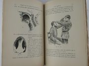 (MEDECINE) Comment on fait parler les sourds-muets. Avec 76 figures.  par L. Goguillot.  Préface de M. le Dr Ladreit de La Charrière. - Image 4