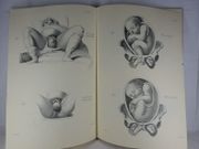 Nouvelles demonstrations d'accouchemens. Avec des planches en taille-douce, accompagnees d'un texte raisonne, popre a en faciliter l'explication, format in-folio. [ facsimile/reprint de l'édition de Paris, 1822 ] par Jean-Pierre MAYGRIER - Image 8