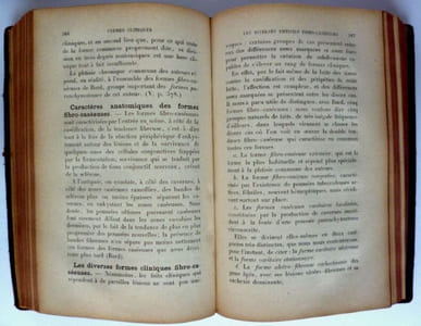 La tuberculose Pulmonaire 