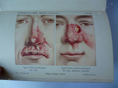Précis des maladies Vénériennes