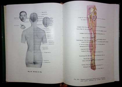 Précis d'Acupuncture Chinoise.