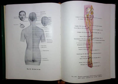 Précis d'Acupuncture Chinoise. 