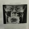 Radiographie bucco-dentaire et agents physiques en stomatologie - la pratique stomatologique - 2e édition. Bertrand Dechaume Lacronique