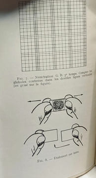 Hématologie clinique - 41 figures 1 hors texte. A. Bécart