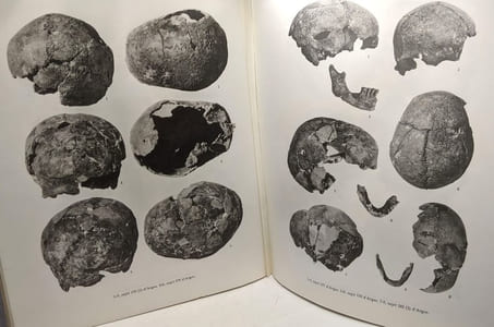 Étude anthropoligue des nécropoles d'Argos - contribution à l'étude des populations de la Grèce Antique - Etudes Péloponnésiennes III école française d'Athènes
