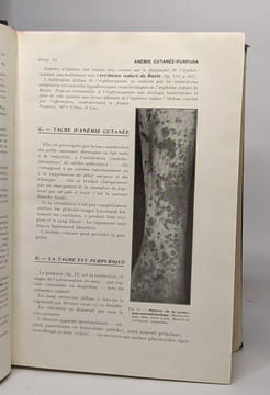 Manuel pratique de dermatologie - le diagnostic la peau et ses réactions - thérapeutique Les dermatoses. Desaux Boutelier