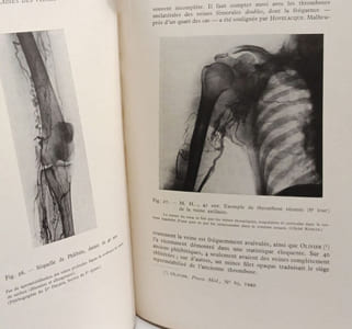 Traité des maladies des veines