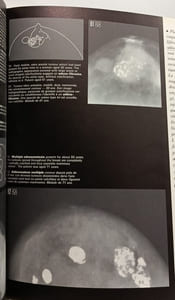 Les Images Mammographiques