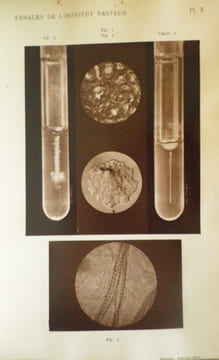 Annales de l'Institut Pasteur (Journal de Microbiologie) - Tome Premier - 1887. Publiées sous le patronage de M. Pasteur.. [PASTEUR (Louis)] - DUCLAUX ...
