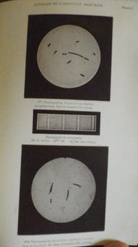 Annales de l'Institut Pasteur (Journal de Microbiologie) - Tome Premier - 1887. Publiées sous le patronage de M. Pasteur.. [PASTEUR (Louis)] - DUCLAUX ...