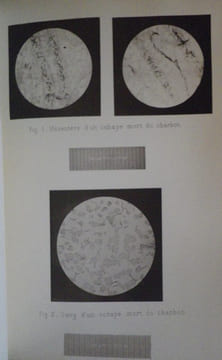 Annales de l'Institut Pasteur (Journal de Microbiologie) - Tome Premier - 1887. Publiées sous le patronage de M. Pasteur.. [PASTEUR (Louis)] - DUCLAUX ...
