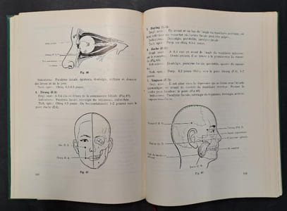 Précis d’acupuncture chinoise. 1re édition