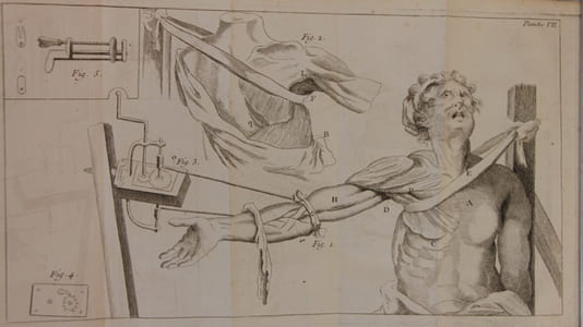 Précis de chirurgie pratique contenant L'Histoire des maladies chirurgicales, & la manière la plus en usage de les traiter; avec des Observations & Remarques critiques sur différens points.