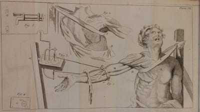 Précis de chirurgie pratique contenant L'Histoire des maladies chirurgicales, & la manière la plus en usage de les traiter; avec des Observations & Remarques critiques sur différens points.