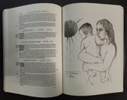 Oeuvres d’Ambroise Paré [3 volumes]. Préfacées par le professeur de Vernejoul & Jean Rostand de l’Académie Française [Reproduction en fac-similé de la quatrième édition revue et augmentée par l’auteur publié à Paris, chez Gabriel Buon, 1585] par PARé, Ambroise - Image 9
