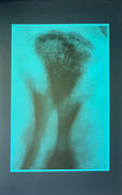 Composition érotique.  par NEIMAN (Yehuda). 