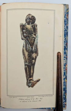Traité des exhumations juridiques, ou considérations sur les changemens physiques que les cadavres éprouvent en se pourrissant dans la terre, dans ...