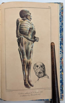 Traité des exhumations juridiques, ou considérations sur les changemens physiques que les cadavres éprouvent en se pourrissant dans la terre, dans ...