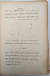 L'Identification des récidivistes