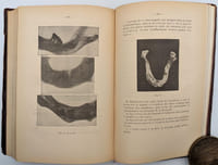 L'Art dentaire en médecine légale