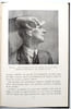 Prise d'Empreintes et Dentier Complet. S.T.FRIPP. L.D.S., R.C.S