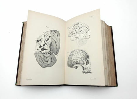 Traité pratique des maladies du système nerveux. GRASSET, Joseph