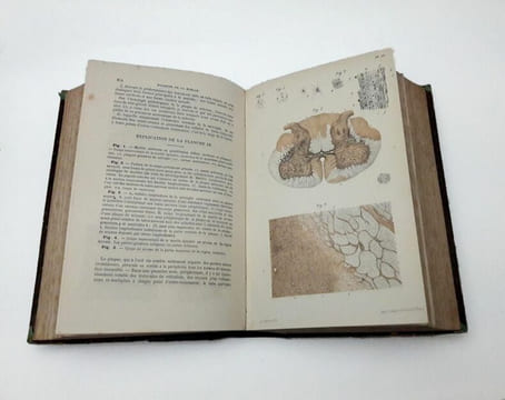 Traité pratique des maladies du système nerveux. GRASSET, Joseph