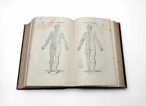Traité pratique des maladies du système nerveux. GRASSET, Joseph