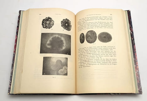 XVIe congrès international de médecine [...] Section XIV : urologie. CONGRÈS INTERNATIONAL DE MÉDECINE] TORDAY, François de (secrétaire)