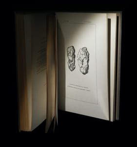 Atlas d'anatomie pathologique chirurgicale urinaire.