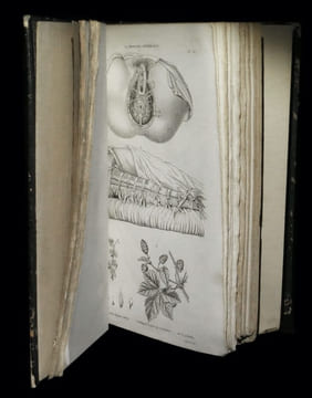 La Médecine pittoresque [Atlas seul].. [BAYLE (Laurent-Antoine)].