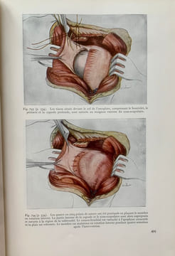 Fractures et lésions articulaires traumatiques (2 volumes). . Watson-Jones, Reginald (Sir)
