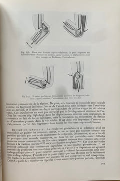 Fractures et lésions articulaires traumatiques (2 volumes). . Watson-Jones, Reginald (Sir)