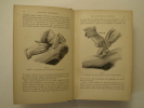 Précis de médecine opératoire. Manuel d'amphithéâtre (ligatures, névrotomies, amputations, résections). Pollosson M.