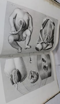 Sullernie memorie anatomico-chirurgiche.. SCARPA (Antonio).