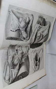 Sullernie memorie anatomico-chirurgiche.. SCARPA (Antonio).